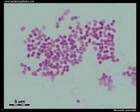 Moraxella catarrhalis microscopy